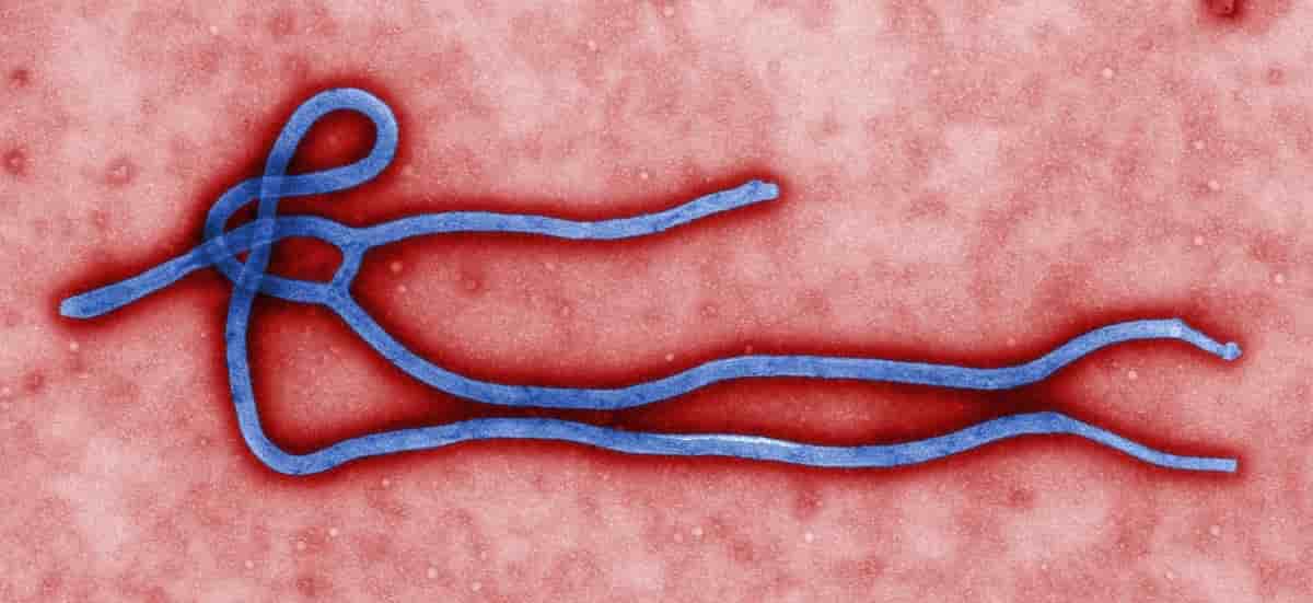 Ebola virus e il cinema
